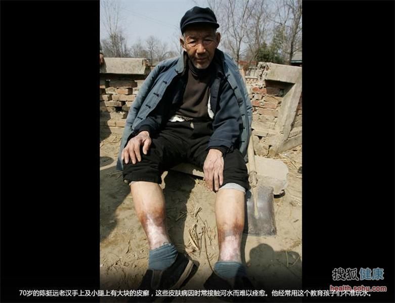 看被癌癥村侵蝕的中國(guó)地圖 悲痛