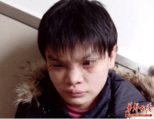 近日，十堰市兒童福利院被曝虐待兒童，其中7名兒童在2012年冬季被活活凍死，引發(fā)廣泛關(guān)注。 網(wǎng)絡(luò)截圖